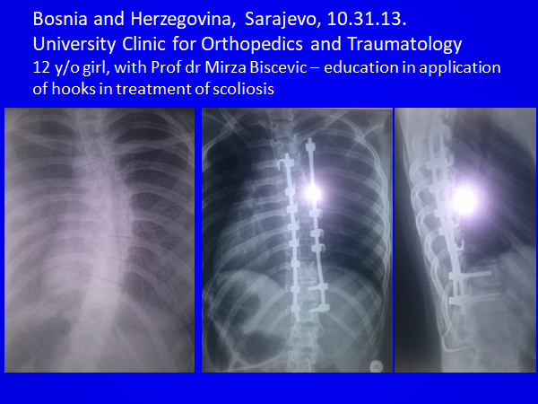 Fre Surgical Services Sarajevo